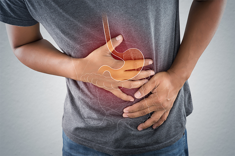 High Stomach Acid Causes and How to Prevent It